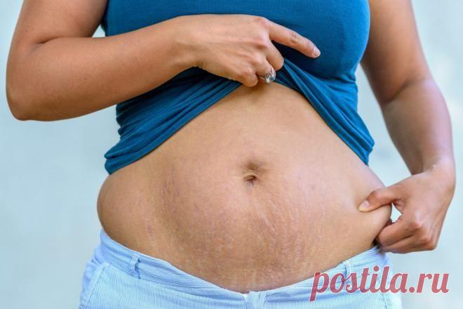 5 причин большого живота, не связанных с регулярным перееданием - Все обо Всем