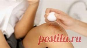 Ушибы, удары и как с ними бороться — Всегда в форме!