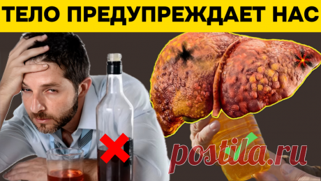 Это 17 признаков того, что печень не в норме? Врачи рассказали, как тело предупреждает нас и что с этим делать | Игорь Ботоговский | Дзен