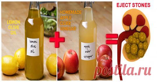 Смешайте оливковое масло, лимонный сок и яблочный уксус, чтобы легко растворить камни в почках - Журнал для женщин