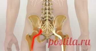 Как разблокировать седалищный нерв: 2 простых способа снять боль 



Как правило, термин «защемление/ущемление седалищного нерва» подразумевает потерю эластичности и гибкости мышц задней поверхности ноги. Это часто связано с процессом возрастного укорочения (ригидн…