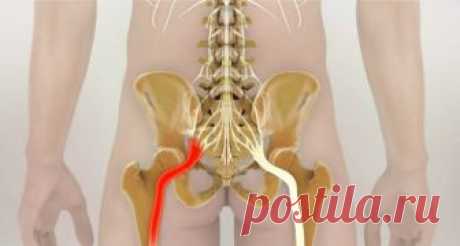 Как разблокировать седалищный нерв: 2 простых способа снять боль
Как правило, термин «защемление/ущемление седалищного нерва» подразумевает потерю эластичности и гибкости мышц задней поверхности ноги. Это часто связано с процессом возрастного укорочения (ригидн…