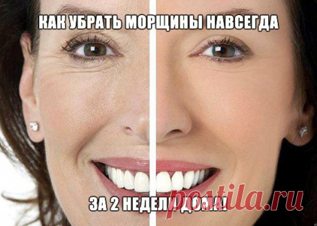 КАК УБРАТЬ ГЛУБОКИЕ МОРЩИНЫ ЗА 2 НЕДЕЛИ!