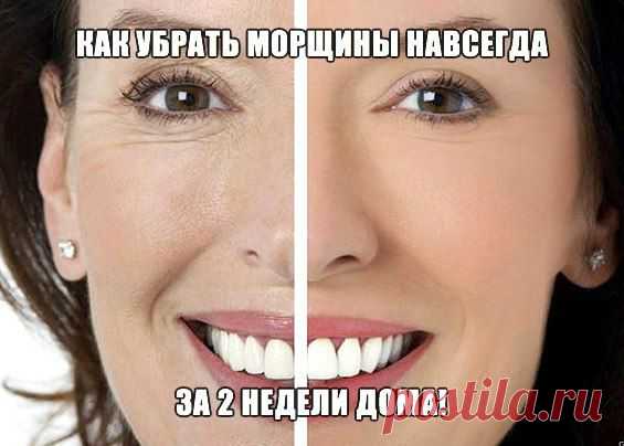 КАК УБРАТЬ ГЛУБОКИЕ МОРЩИНЫ ЗА 2 НЕДЕЛИ!