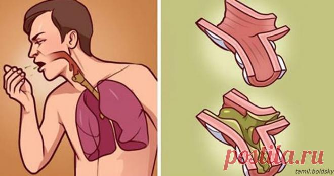 Актуальная тема. Как убрать слизь из горла