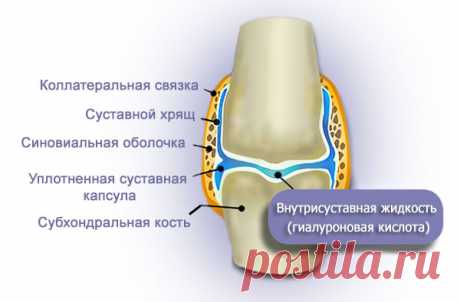Гиалуроновая кислота для суставов: эффект, как применять, показания