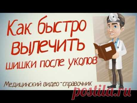 Шишки от уколов: 10 способов быстрого избавления от них.
