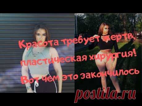 Ростовская модель вбухала кучу денег в пластику.  Вот чем это закончилось - YouTube