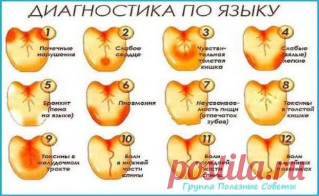 Сохраните, чтобы не потерять
СОВЕТ 1: Как по языку узнать о сбоях в работе позвоночника, желудка, печени и предотвратить их?
В медицине очень мало правил без исключений, но среди них есть одно такое правило: симптомы заболеваний проявляются на языке примерно за сутки–двое до того, как начинают болеть пораженные органы. 
Диагностику по языку следует проводить утром, натощак, при естественном дневном освещении и после предварительного ополаскивания ротовой полости.
При осмот...