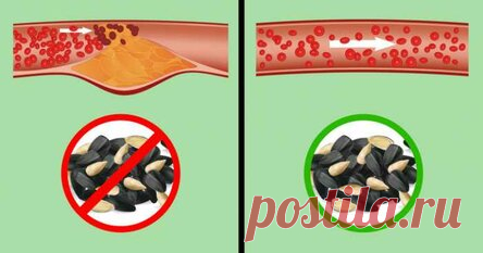 Что происходит с организмом, когда вы часто едите семечки И правда ли, что они провоцируют аппендицит