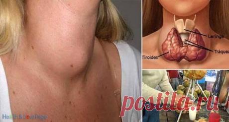 Врачи никогда не скажут Вам это: щитовидную железу можно вылечить с помощью всего одного ингредиента