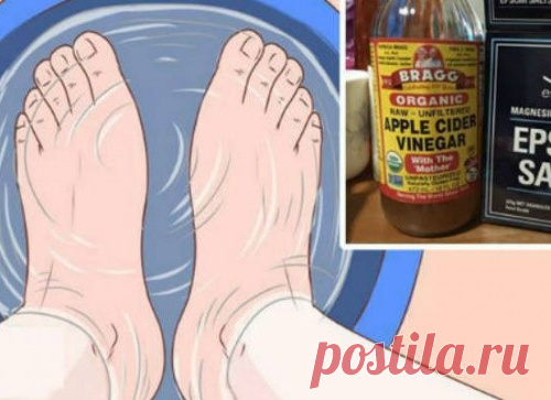 Ванна для ног с солью Эпсома и яблочным уксусом. Рецепт: Облегчит боль в течение 20 минут