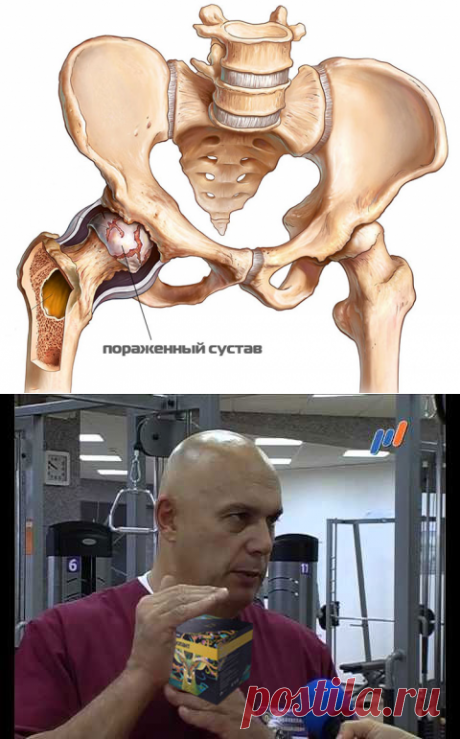 Проблемы с суставами — прямой путь к инвалидности! Как спасти себя и забыть о боли?