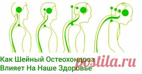 Осторожно! Болит Шея?