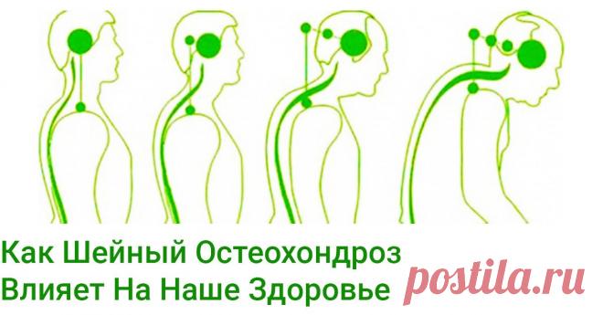 Осторожно! Болит Шея?