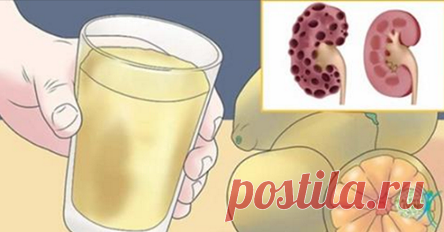 Прекратите делать эти 8 ошибок, которые наносят ущерб вашим почкам