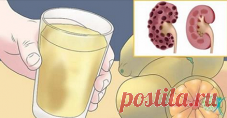 Прекратите делать эти 8 ошибок, которые наносят ущерб вашим почкам