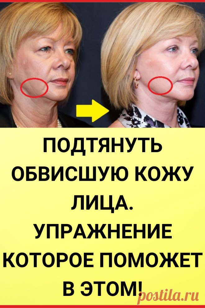 Подтянуть обвисшую кожу лица. Упражнение которое поможет в этом!