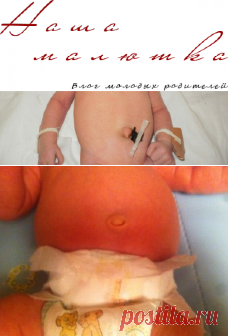 Пупок новорожденного. Уход за пупком малыша. |