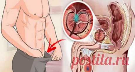 12 ранних предупреждающих признаков рака предстательной железы, который должен знать каждый парень! Не игнорировать! - Полезные советы красоты