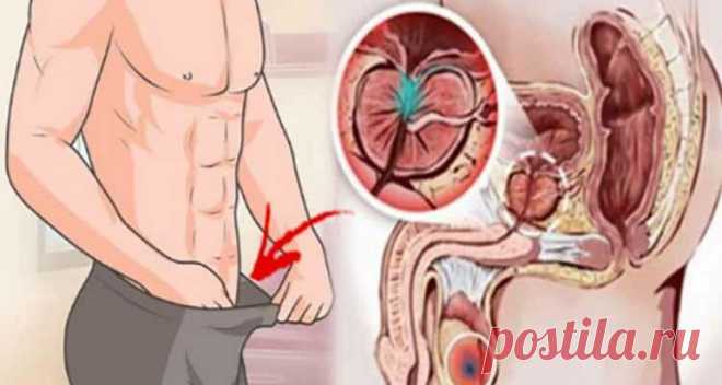 12 ранних предупреждающих признаков рака предстательной железы, который должен знать каждый парень! Не игнорировать! - Полезные советы красоты