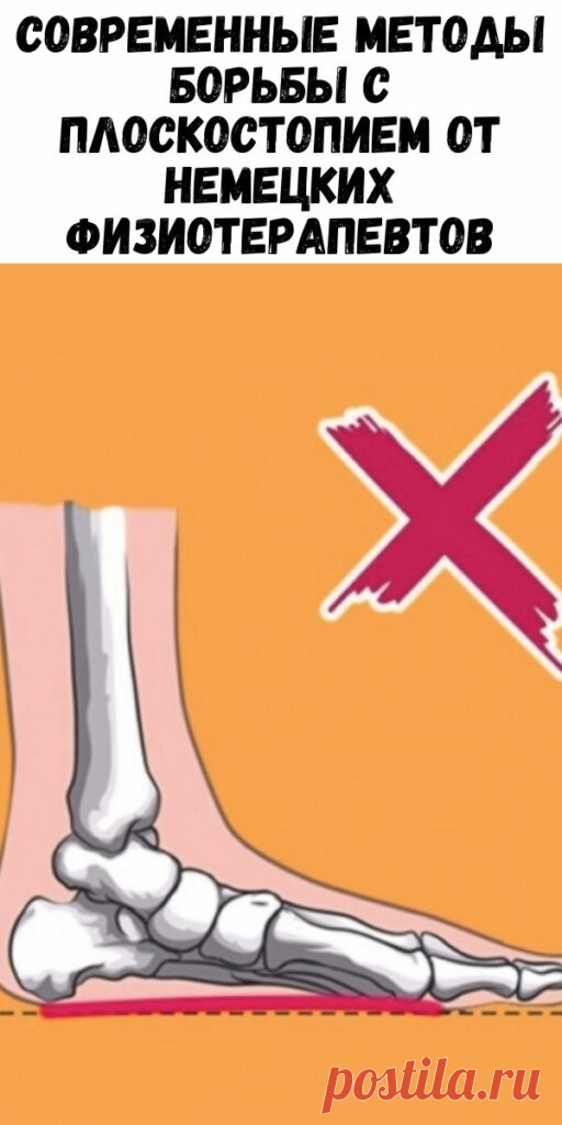 Современные методы Борьбы с плоскостопием от немецких физиотерапевтов - Упражнения и похудение