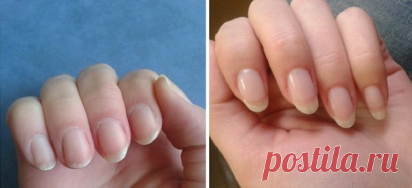 Как быстро отрастить ногти, которые никогда не сломаются: поможет простое средство из 4 компонентов! » Главная | Клёво.ком