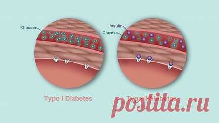 Почему употребление чая может помочь предотвратить и контролировать диабет 2-го типа