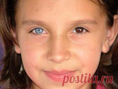 Глаза разного цвета: приметы и суеверия