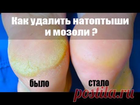 Это копеечное средство избавит вас от мозолей и натоптышей за 3 приминения
Казалось бы, что трещины на ступнях это проблема более эстетическая, но не нет, ведь если трещины не лечить, то они могут кровоточить и доставлять массу неприятностей, болевые ощущения. Поэтому, не н…