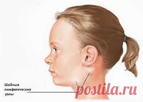 От лимфаденита есть защита | Друг пенсионера
С мужем я развелась, когда дочке было два годика. Все говорили, что я ненормальная, что не подниму одна такого маленького ребенка. Но я решила, что дочке будет лучше без отца, чем с папой-алкоголиком.