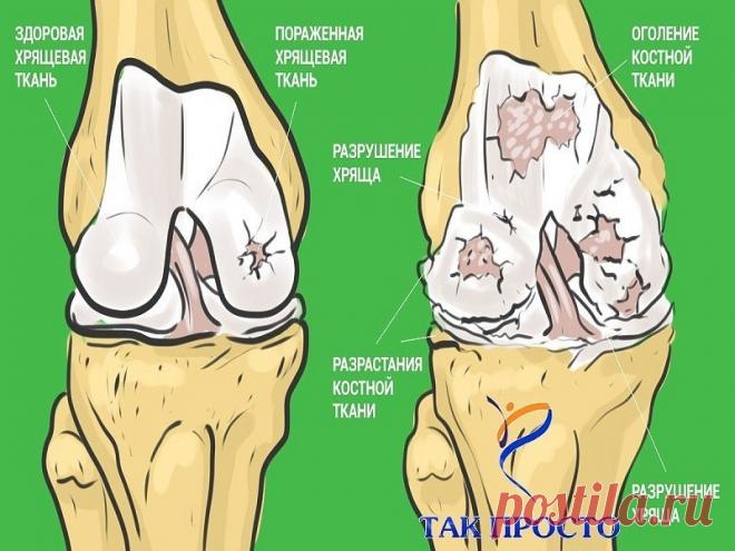 Принимаю желатин для здоровья суставов, красоты кожи и волос.
