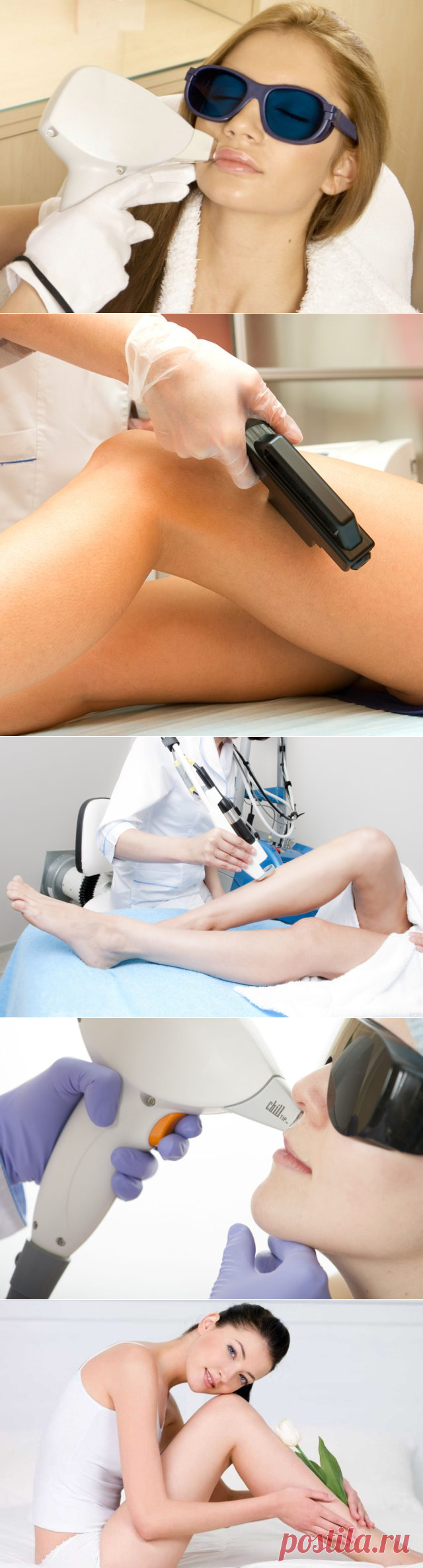 Лазерная эпиляция — плюсы и минусы