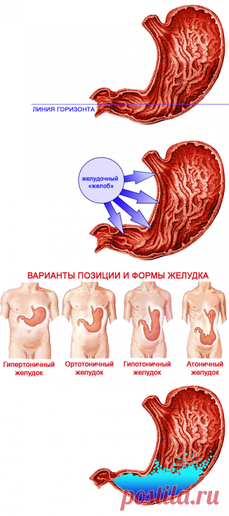 Как и зачем пить соду и воду