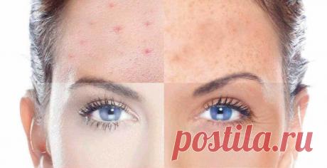 Уход за лицом. Жирная или сухая кожа. Кому повезло больше?