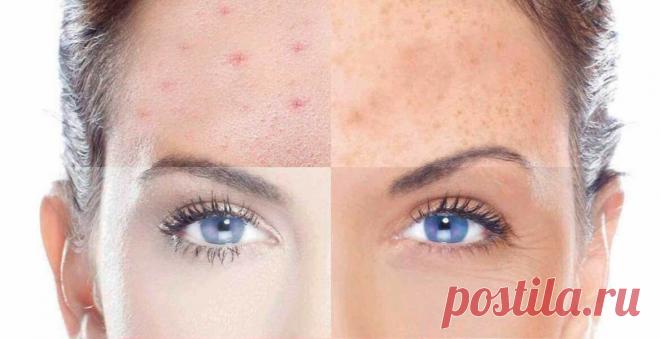 Уход за лицом. Жирная или сухая кожа. Кому повезло больше?