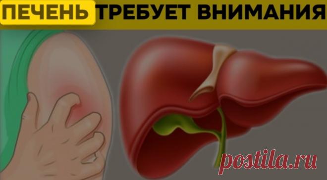 Как ваше тело предупреждает о проблемах с печенью после 40: 11 признаков, на которые стоит обратить внимание | Игорь Ботоговский | Дзен