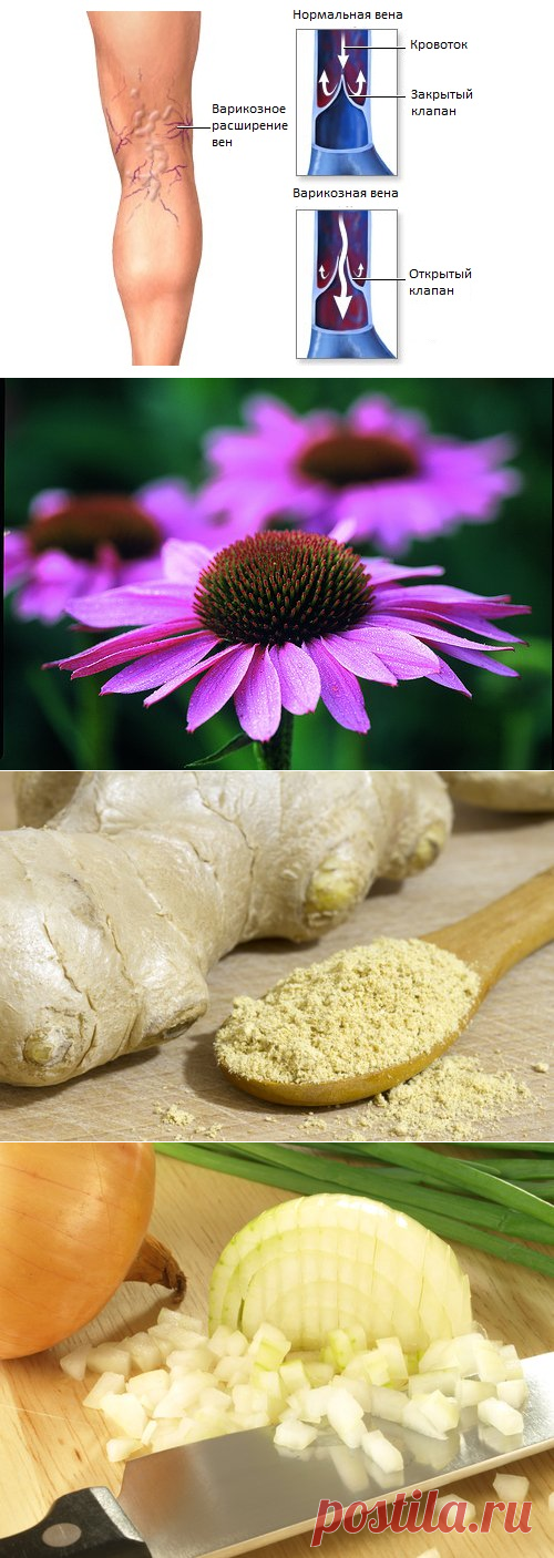 10 лекарственных растений, которые помогут вылечить варикоз - Шаг к Здоровью