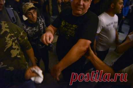 После столкновений на акции в Ереване госпитализированы несколько человек. ​Помощь врачей потребовалась демонстрантам и полицейским.