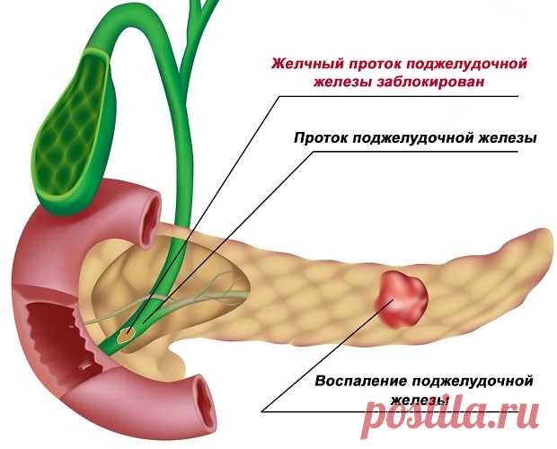Лечение поджелудочной железы народными средствами в домашних условиях