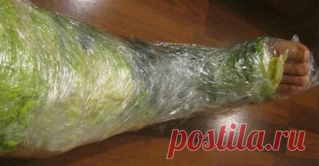 ЛЕЧЕНИЕ СУСТАВОВ КАПУСТНЫМ ЛИСТОМ
С возрастом суставы начинают напоминать о себе периодическими болями, которые могут быть как ноющими, так и острыми. В народной медицине существует масса способов избавления от подобного недуга. Возможно, вы удивитесь, но помочь при проблемах с суставами может капуста, та самая, которую тушат, из которой делают салаты и вкуснейшие голубцы.
Капустный лист при воспалении коленных суставов
Возьмите капустный лист, сделайте на нем небольшие засечки. Нагрейте над