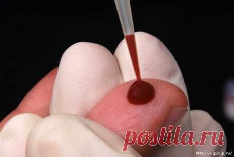 КАК РАЗЖИЖАТЬ ГУСТУЮ КРОВЬ БЕЗ ЛЕКАРСТВ — Полезные советы домохозяйкам