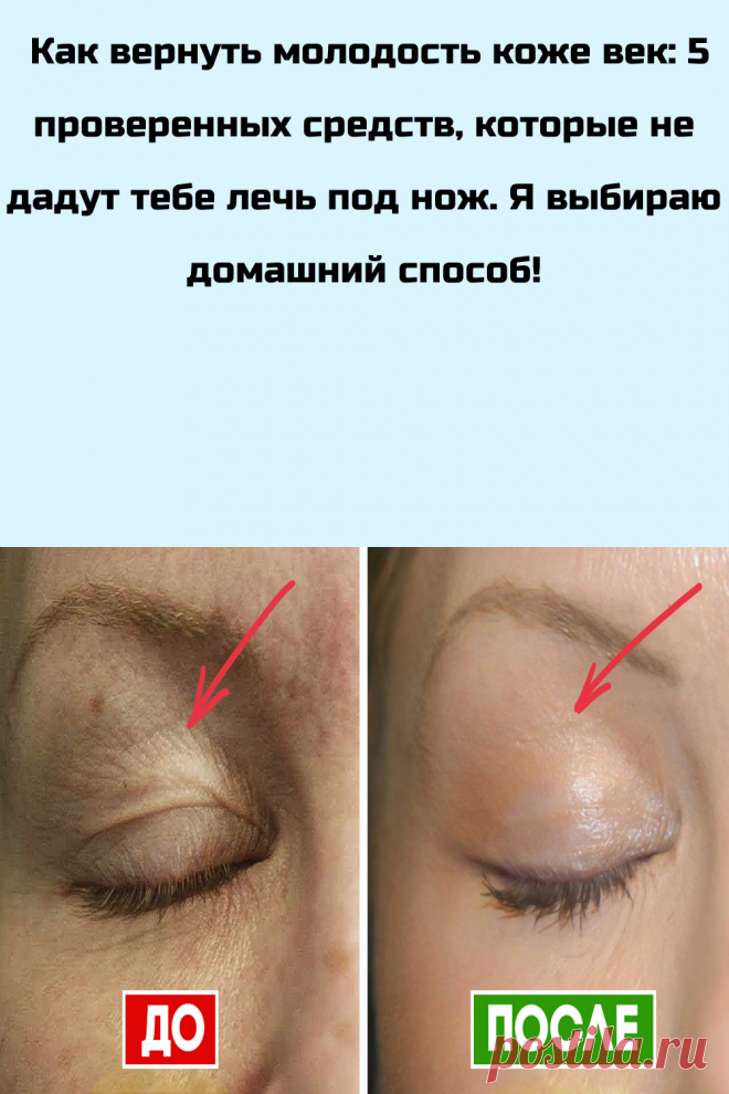 Как вернуть молодость коже век: 5 проверенных средств, которые не дадут тебе лечь под нож. Я выбираю домашний способ!