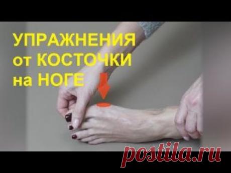 Упражнения от косточки на ноге. Комплекс для лечения большого пальца ноги – лечебная гимнастика при артрозе большого пальца, при hallux valgus - халюс вальгу...