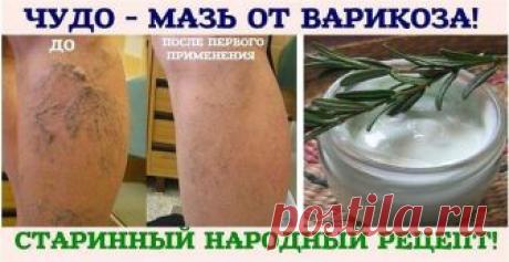 Потрясающая мазь от варикоза