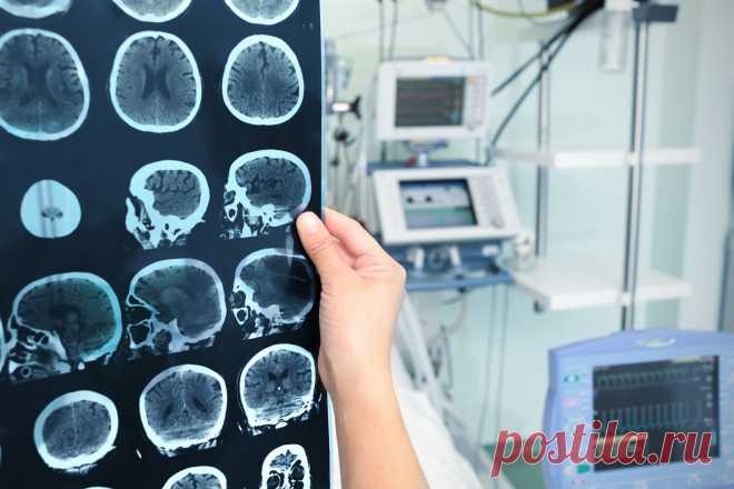 ГЛУБОКАЯ СТИМУЛЯЦИЯ МОЗГА ПРИ ДЕПРЕССИВНЫХ СОСТОЯНИЯХ
Помощь при депрессии нередко затруднена из-за сложной природы этого расстройства. В одних случаях помогают специальные медикаменты, в других – сеансы психотерапии. Нередко помощь при депрессии основывается на комбинации данных видов лечения. Однако примерно в каждом третьем случае диагностируется так н...