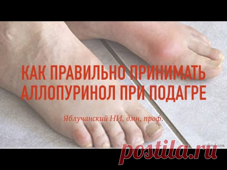Как правильно принимать аллопуринол при подагре