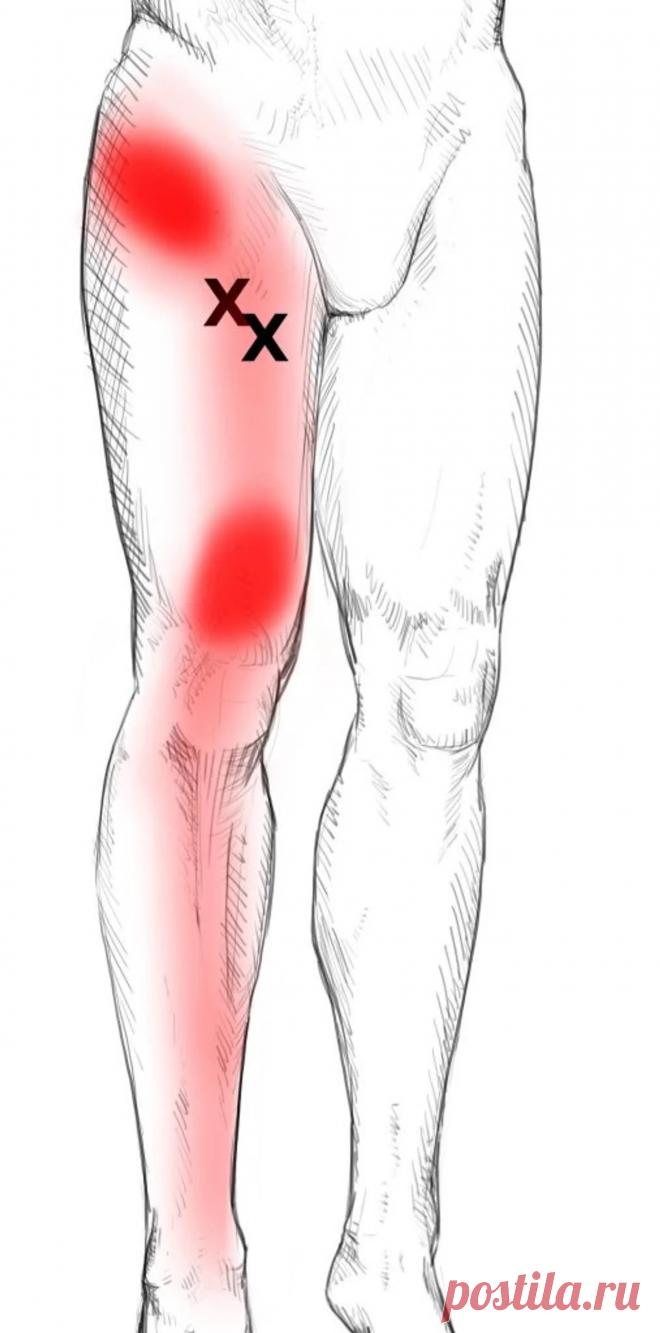 Приводящие мышцы. Самомассаж