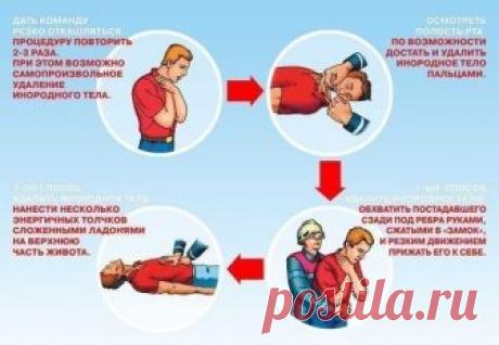 Прием Геймлиха. Это надо знать каждому