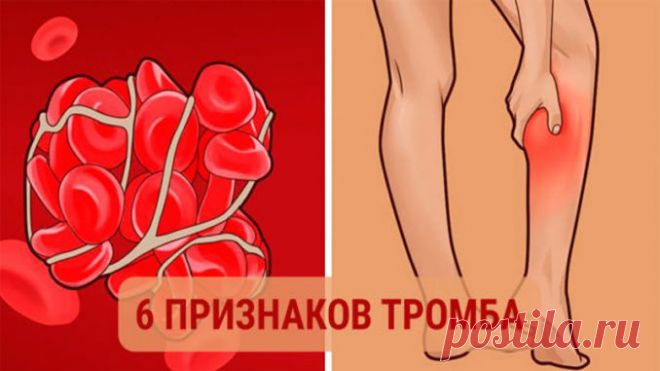 Не игнорируй это. Симптоматика наличия в организме тромба — Полезные советы